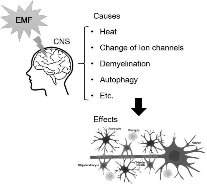 Studie  Bild Gehirneffekt